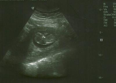 Bild zu Zurück vom FA - Baby Forum - Allgemeine Themen