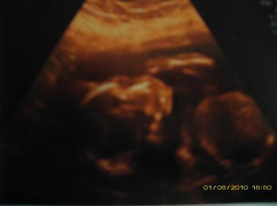 Bild zu US -foto - Baby Forum - Allgemeine Themen