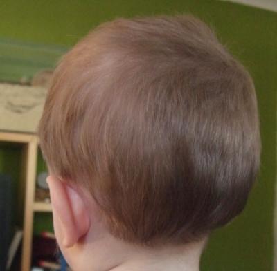 Bild zu