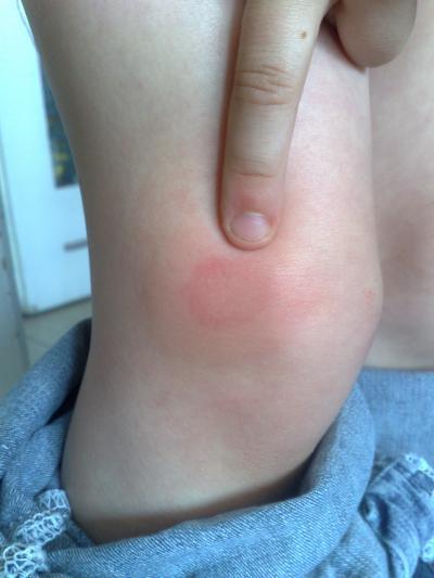 Bild zu was mag das sein? - Baby Forum - Allgemeine Themen