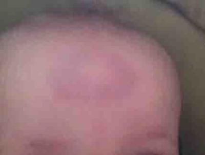 Bild zu Guten Abend...man, was für ein Sch....Tag! Mit dem Rettungswagen und Kind ins.. - Baby Forum - Allgemeine Themen