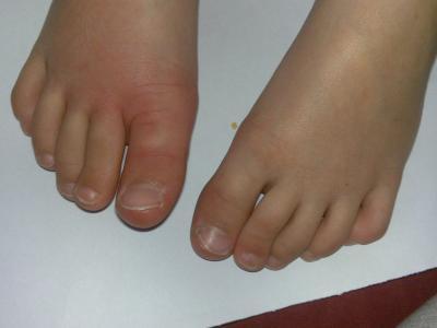 Bild zu 