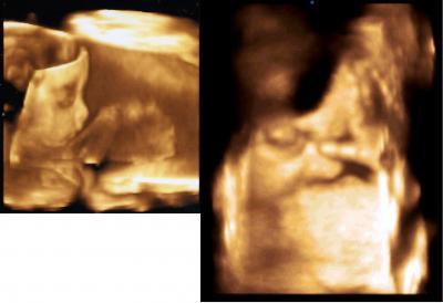 Bild zu Hallo zusammen, bin geschafft! - Baby Forum - Allgemeine Themen