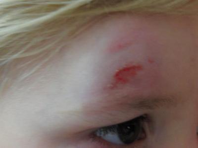 Bild zu 