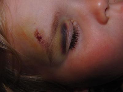 Bild zu es wird schlimmer statt besser - Baby Forum - Allgemeine Themen