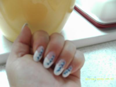 Bild zu nicht ideal,aber besser als gestern - Baby Forum - Allgemeine Themen