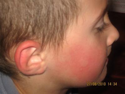 Bild zu Oh mein armer Kleiner! - Baby Forum - Allgemeine Themen