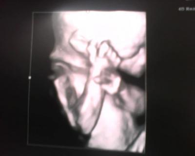 Bild zu Mädels: Babynews! - Baby Forum - Allgemeine Themen