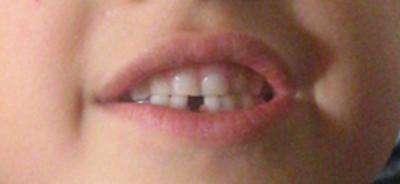 Bild zu Mein Älterer ist so stolz - Baby Forum - Allgemeine Themen