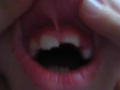 Bild zu Mein Sohn hatte am Freitag einen Schulunfall ... - Baby Forum - Allgemeine Themen