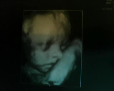 Bild zu Nochmal 3D, wer mal schauen mag... - Baby Forum - Allgemeine Themen