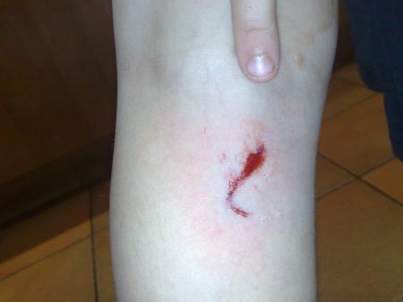 Bild zu 