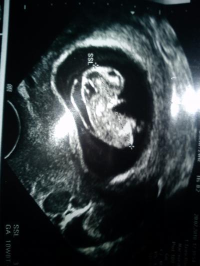 Bild zu habe meine handybilder mal aufs läppi gebracht - ultraschallbild - Baby Forum - Allgemeine Themen