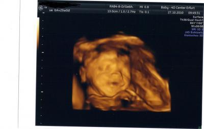 Bild zu Bin ganz verliebt...war beim 4D Schall!!! - Baby Forum - Allgemeine Themen