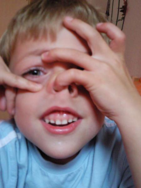 Bild zu