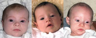 Bild zu Bitte vergleicht mal - Baby Forum - Allgemeine Themen