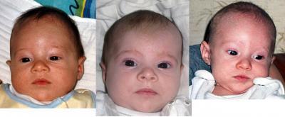 Bild zu Nochmal Vergleichsbild - Baby Forum - Allgemeine Themen
