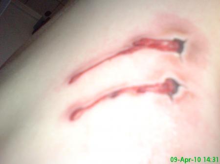 Bild zu