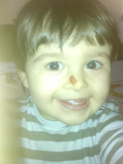 Bild zu Mein Baby hat Aua :-( - Baby Forum - Allgemeine Themen