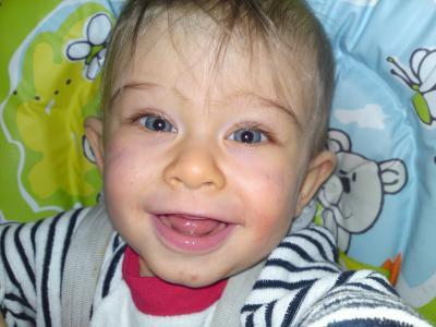 Bild zu Orange Nase - Baby Forum - Allgemeine Themen