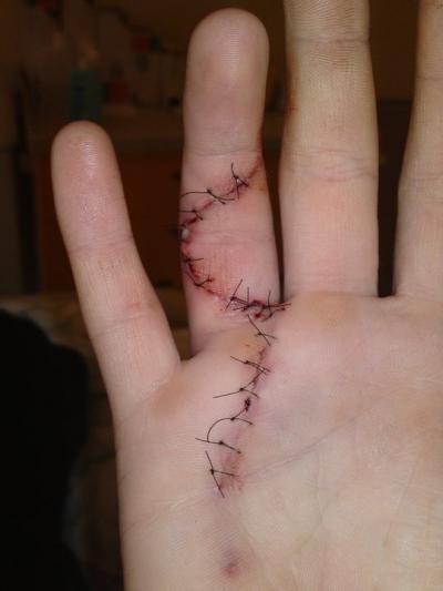 Bild zu Finger.... - Baby Forum - Allgemeine Themen