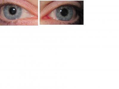 Bild zu Aua was mach ich mit meinem Auge?? - Baby Forum - Allgemeine Themen