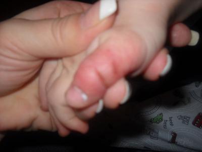 Bild zu Bitte schaut euch das mal an , vllt könnt ihr uns helfen! - Baby Forum - Allgemeine Themen