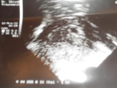 Bild zu schaut mal mädls sieht das gut aus??-) - Baby Forum - Allgemeine Themen