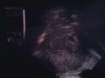 Bild zu könnt ihr was erkennen? - Baby Forum - Allgemeine Themen