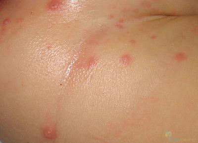 Bild zu so sehen sie aus.. - Baby Forum - Allgemeine Themen