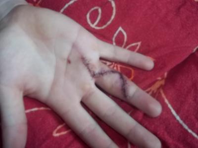 Bild zu Finger-Update - Baby Forum - Allgemeine Themen