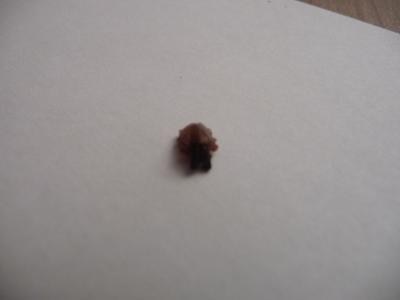 Bild zu Kennt jemand dieses Insekt...., oder was das ist? - Baby Forum - Allgemeine Themen