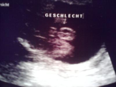 Bild zu Evtl. Ratespiel - Baby Forum - Allgemeine Themen
