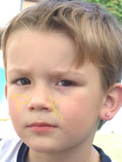 Bild zu zum ohrring nochmal - Baby Forum - Allgemeine Themen