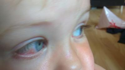 Bild zu was ist das?? - Baby Forum - Allgemeine Themen