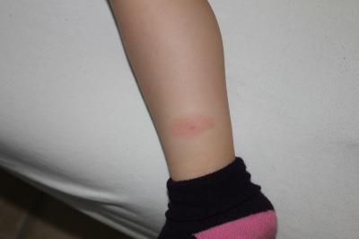 Bild zu Was meint ihr was das ist?? - Baby Forum - Allgemeine Themen