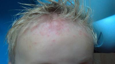 Bild zu hilfe was ist das? - Baby Forum - Allgemeine Themen