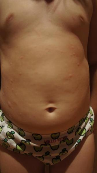 Bild zu Hilfe - was kann meine Maus haben? - Baby Forum - Allgemeine Themen