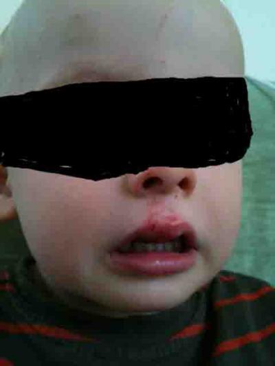 Bild zu Ein spätes Hallo.....habt mal ein bißchen Mitleid für meinen Lütten....... - Baby Forum - Allgemeine Themen