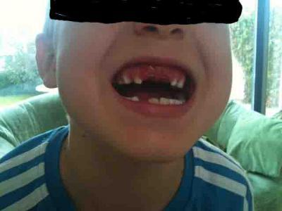 Bild zu Bitte nicht gruseln....  ;-)  Ab heute gibts für den Großen nur noch Suppe.... - Baby Forum - Allgemeine Themen