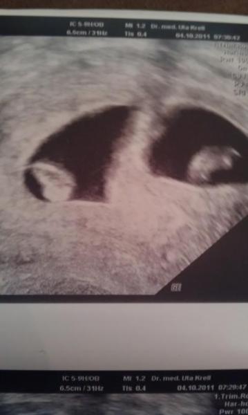 Bild zu Hatte heute meinen ertsen FA Termin! - Baby Forum - Allgemeine Themen