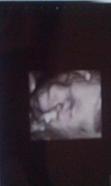 Bild zu darf ich vorstellen? - Baby Forum - Allgemeine Themen