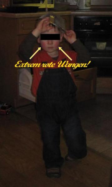 Bild zu Auch Frage "Was könnte es sein?" wegen extrem roten Wangen... - Baby Forum - Allgemeine Themen