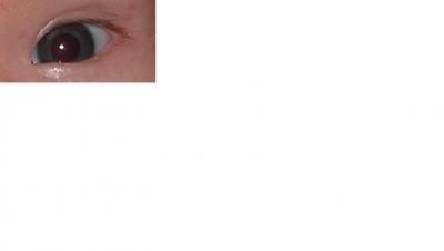 Bild zu blau oder braun? - Baby Forum - Allgemeine Themen