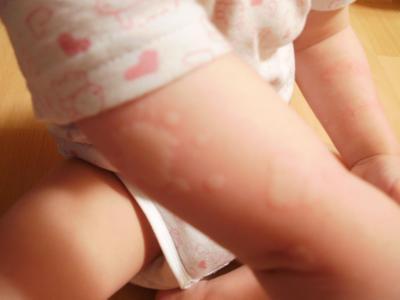 Bild zu Schaut mal bitte, könnt ihr helfen? - Baby Forum - Allgemeine Themen