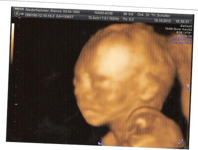 Bild zu Ich liebe ihn jetzt schon - Baby Forum - Allgemeine Themen