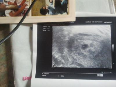 Bild zu Bitte - Baby Forum - Allgemeine Themen
