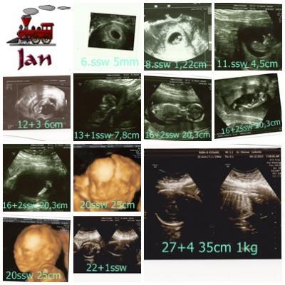 Bild zu Mal kurz melden - Baby Forum - Allgemeine Themen