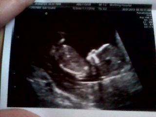 Bild zu MEIN ZAPPELWURM es war so tooooolll :))))) - Baby Forum - Allgemeine Themen