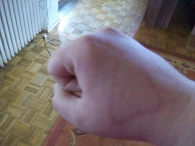 Bild zu Komische "Zeichnung" auf der Hand - Baby Forum - Allgemeine Themen